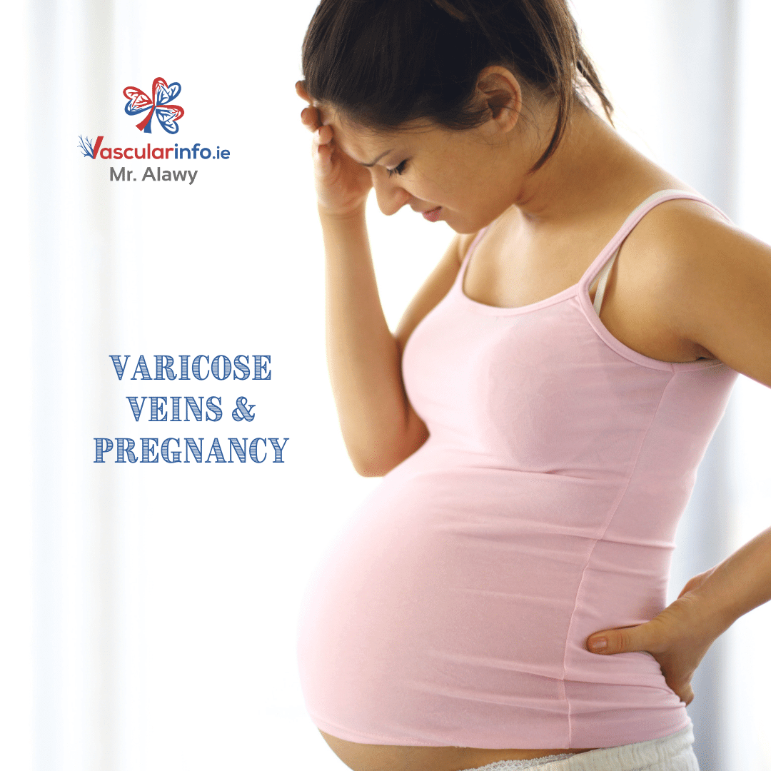 Varicose Veins & Venous Diseases