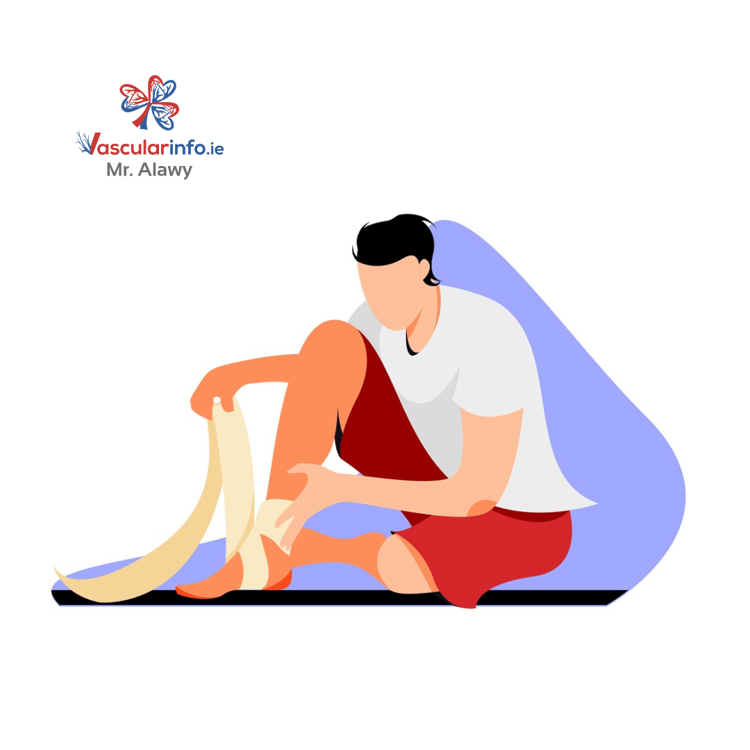 Varicose Veins & Venous Diseases