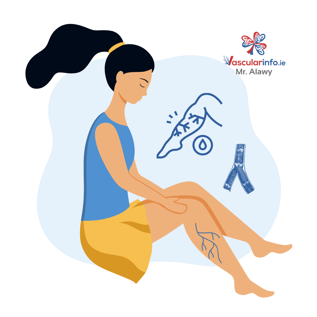 Varicose Veins & Venous Diseases