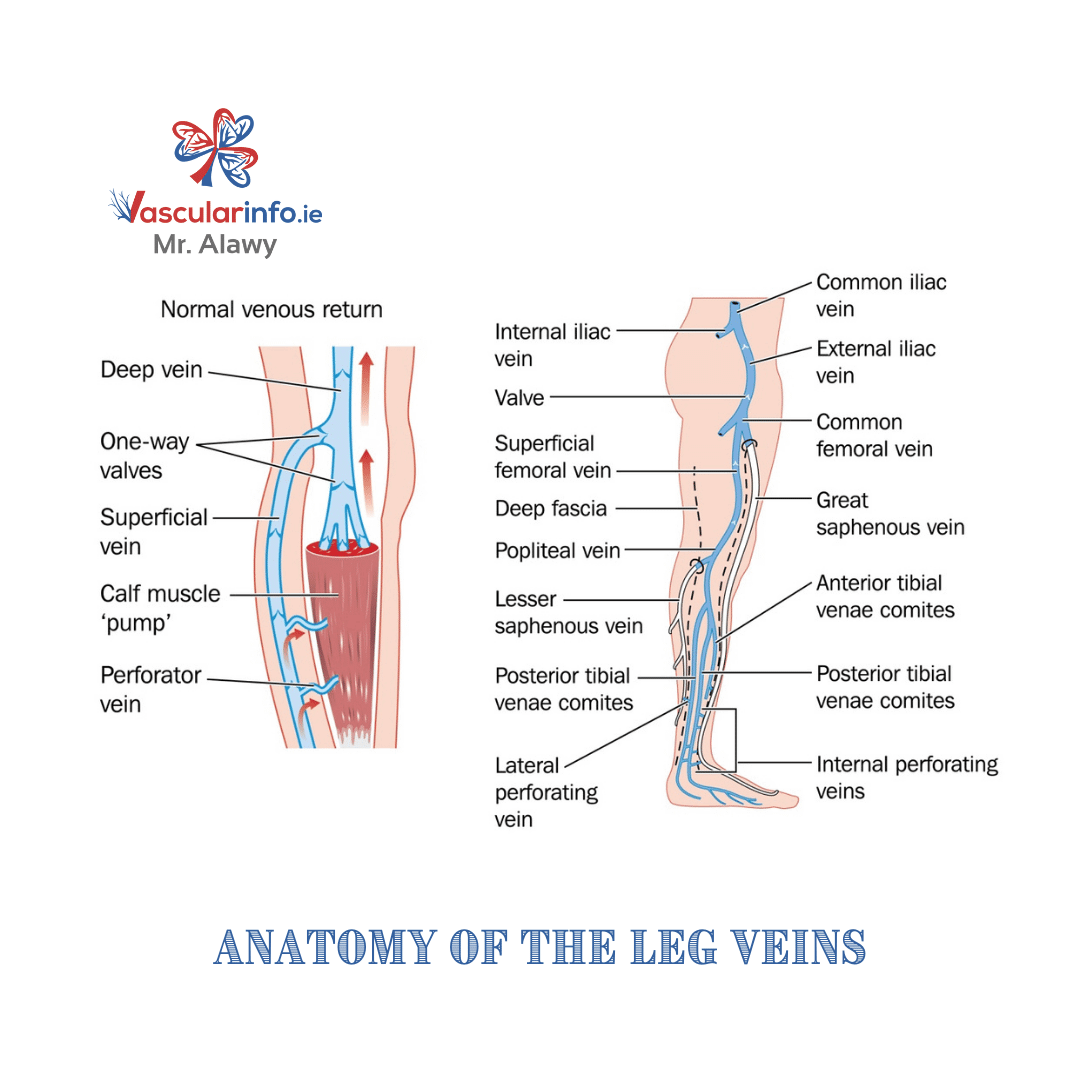 Varicose Veins & Venous Diseases