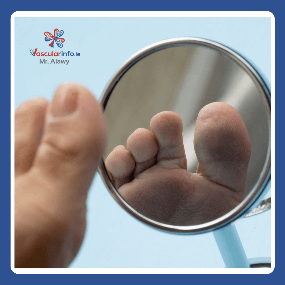 Diabetic Foot