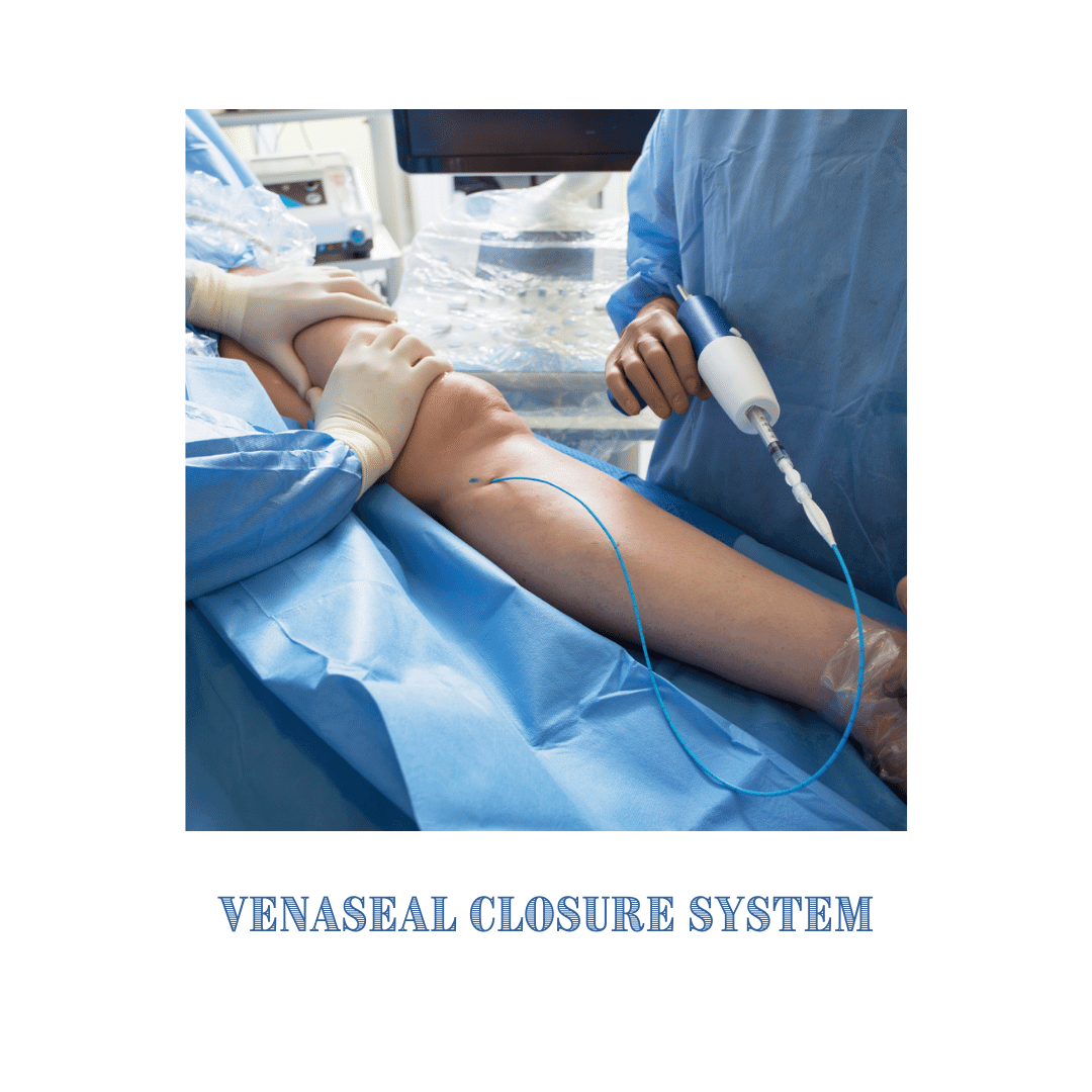 Varicose Veins Procedures