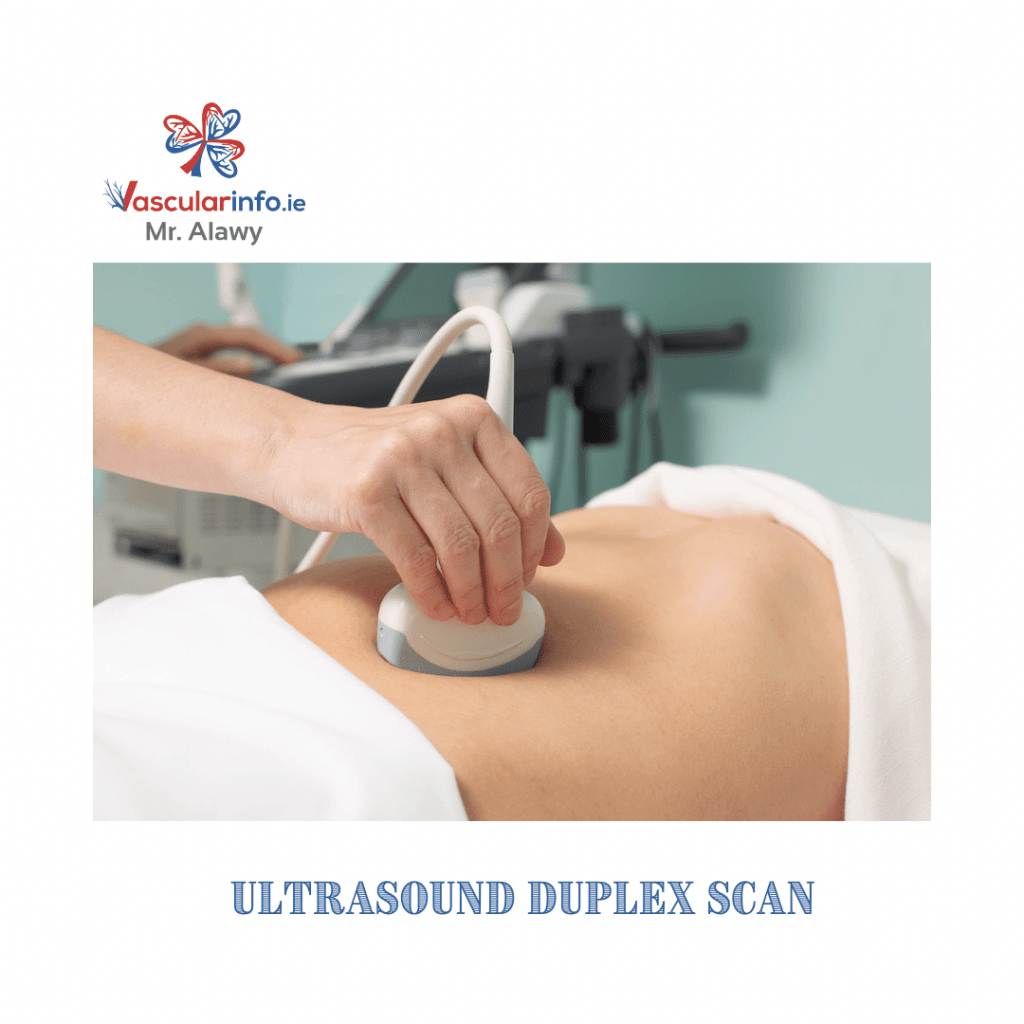 Abdominal Aortic Aneurysm(AAA) - Vascular Info