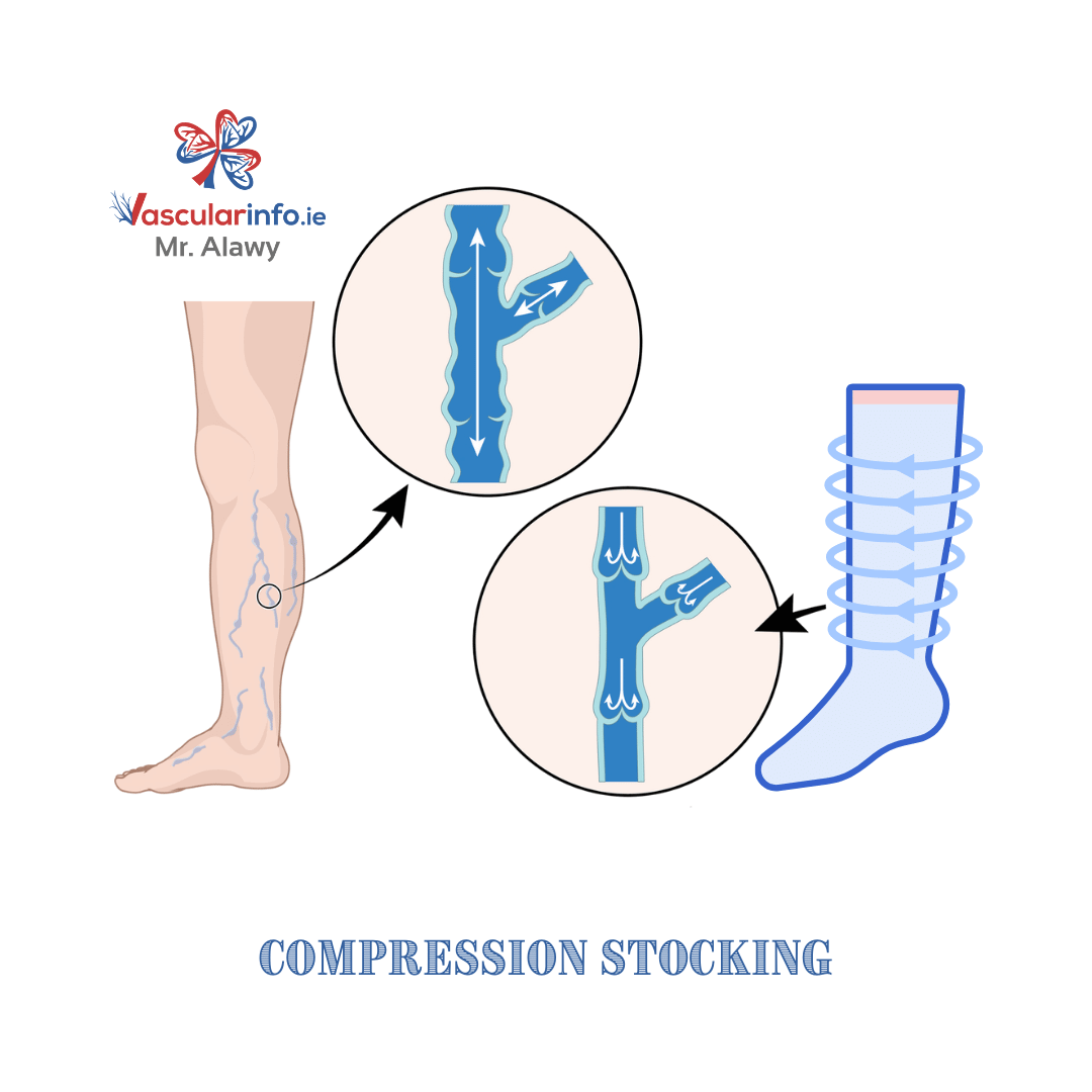 Varicose Veins & Venous Diseases