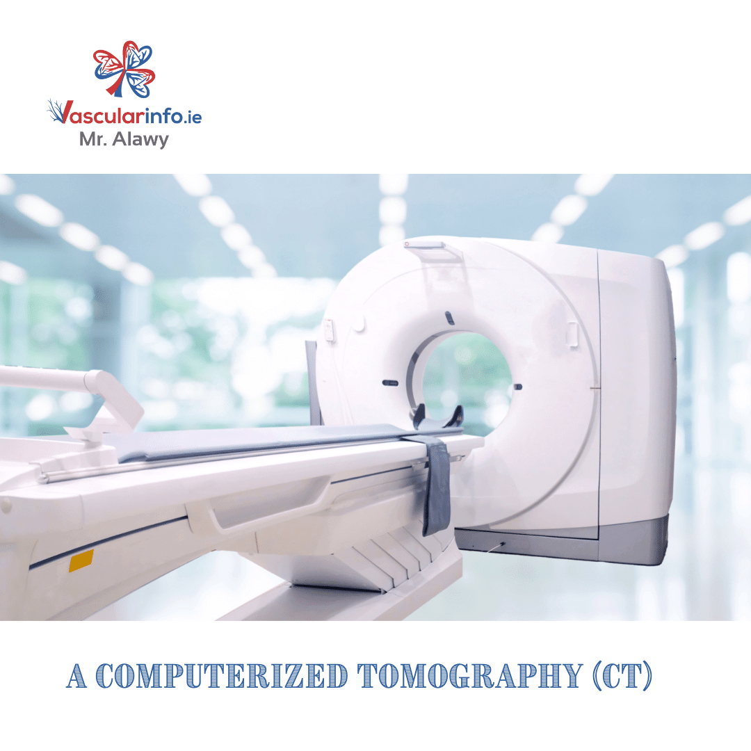 Angioplasty