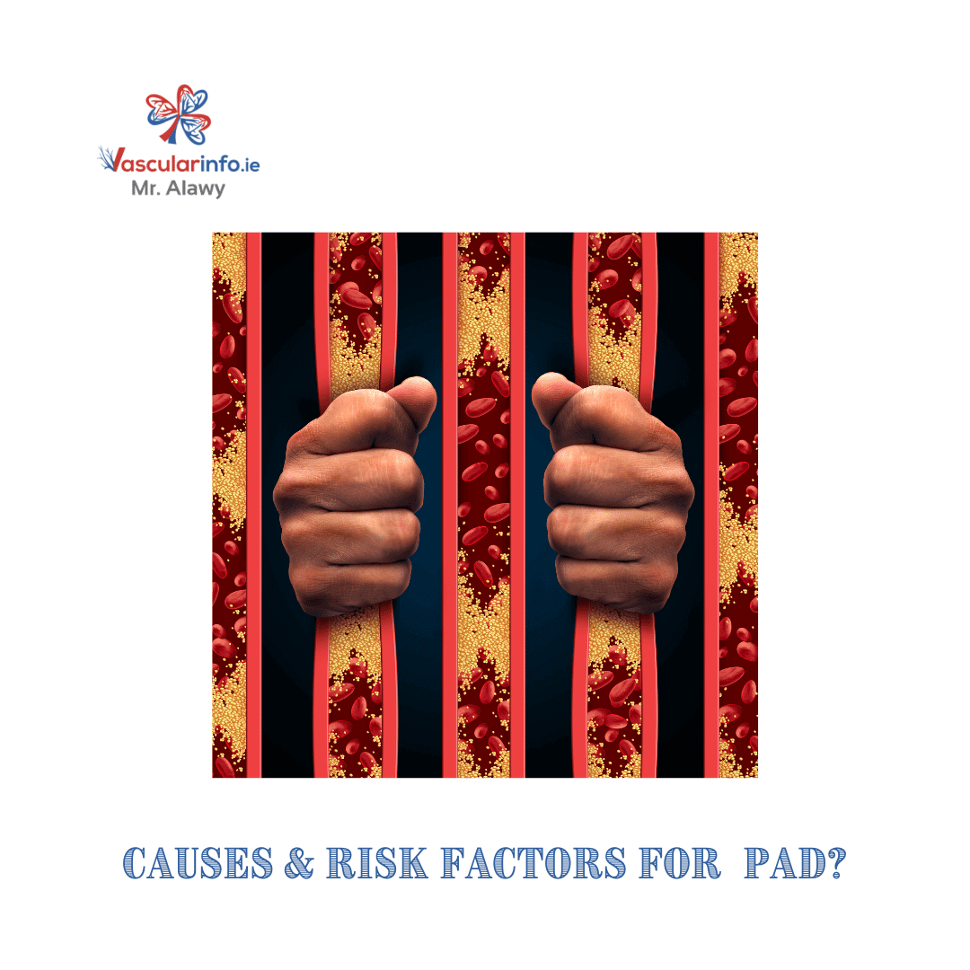 Peripheral Arterial Disease