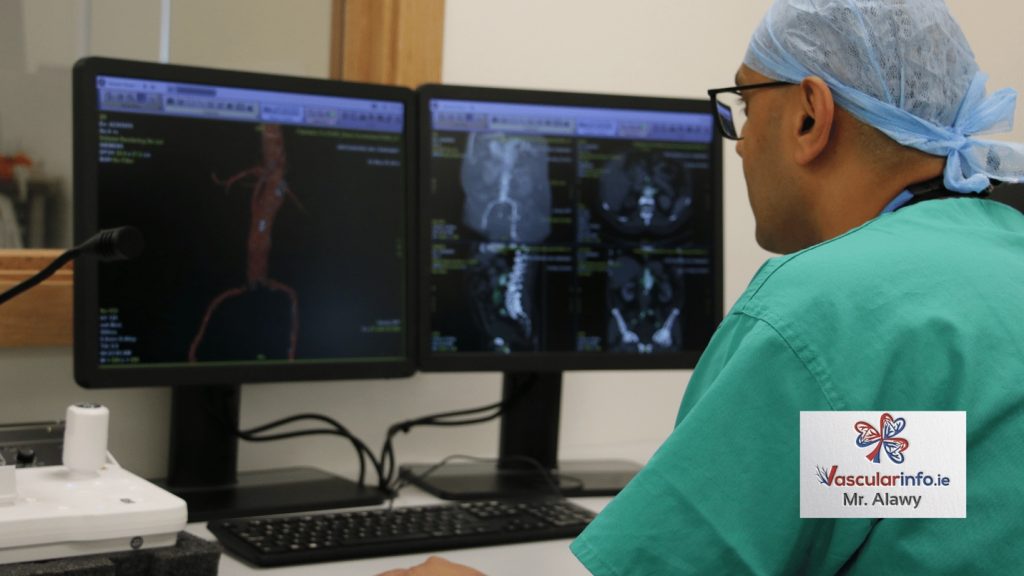 Complex Endovascular Repair of Aortic Aneurysms