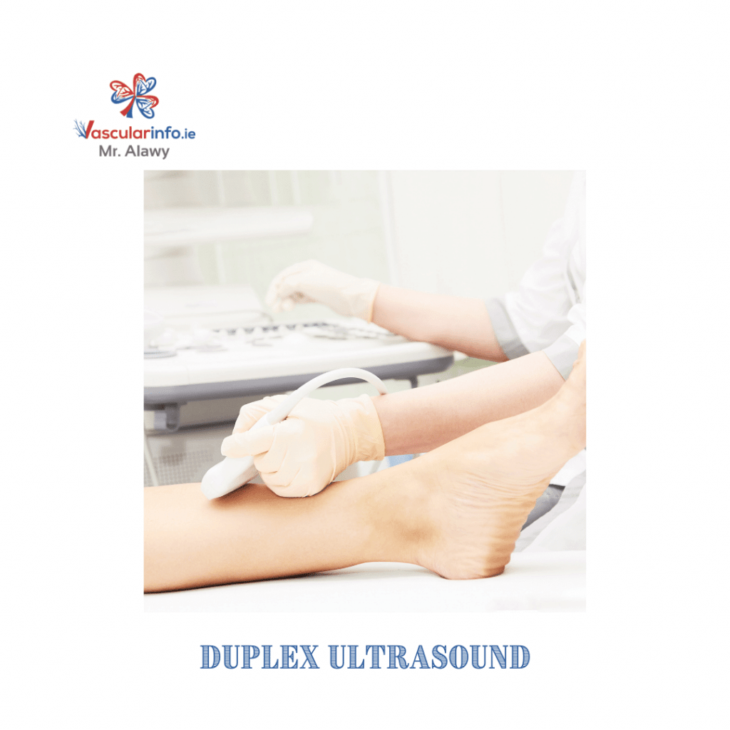Peripheral Arterial Disease