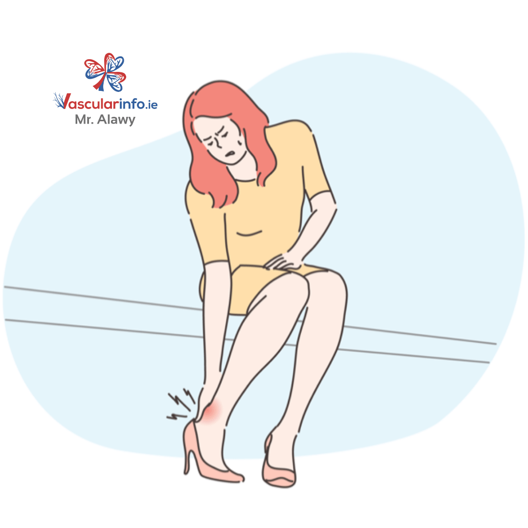 Varicose Veins Procedures