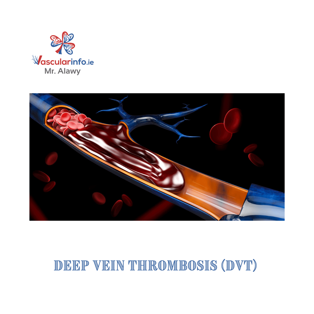 Varicose Veins Procedures