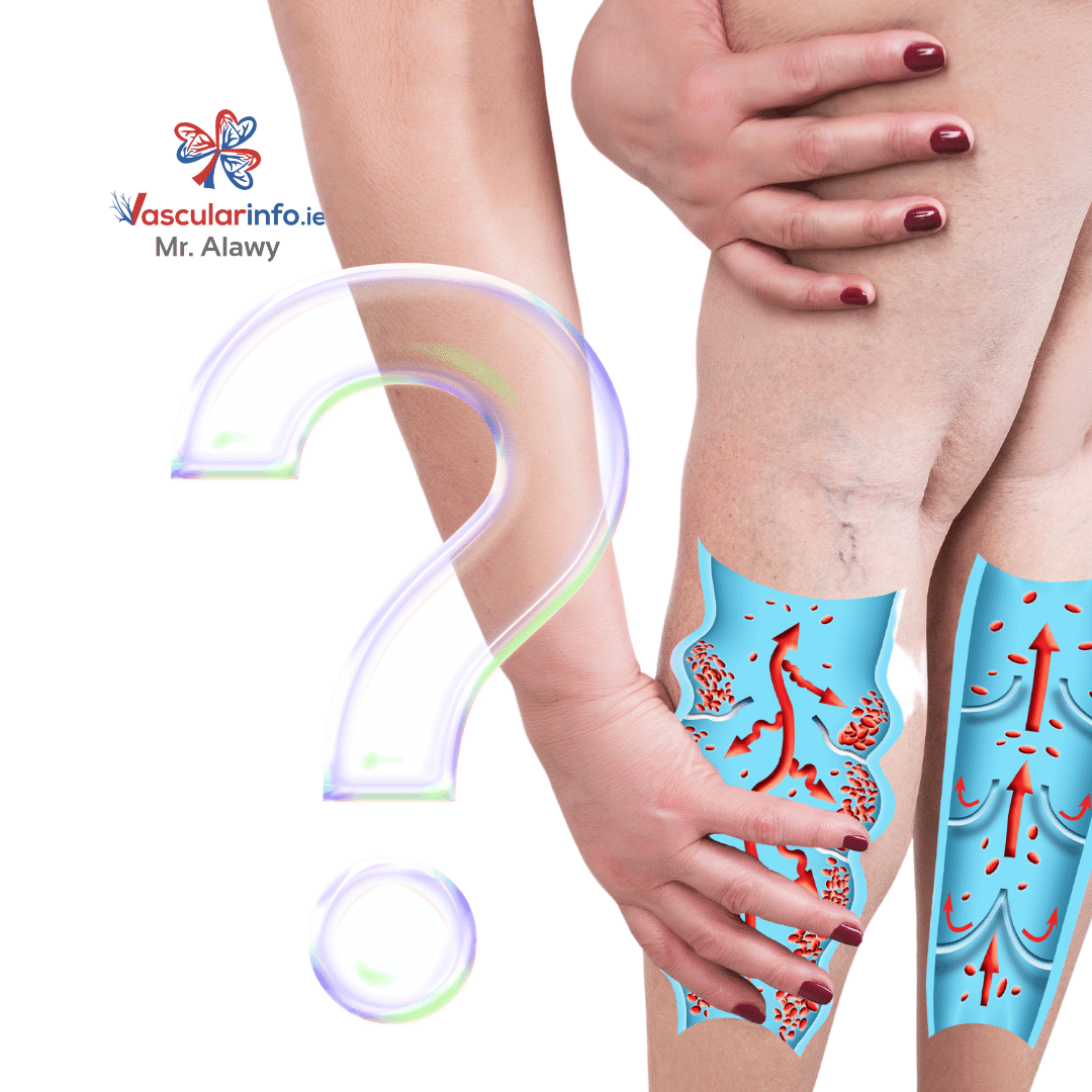 Varicose Veins Procedures